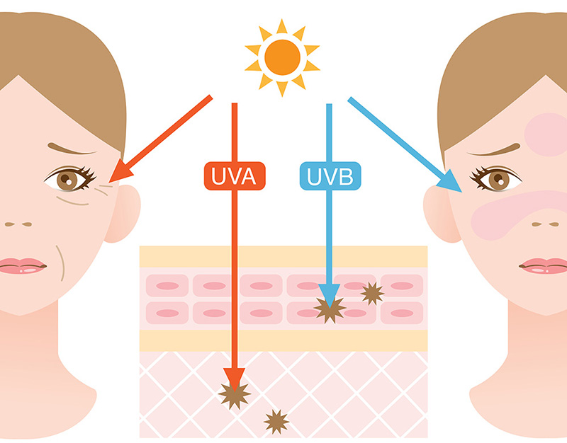 肌膚傷害是短波UVA或UVB造成