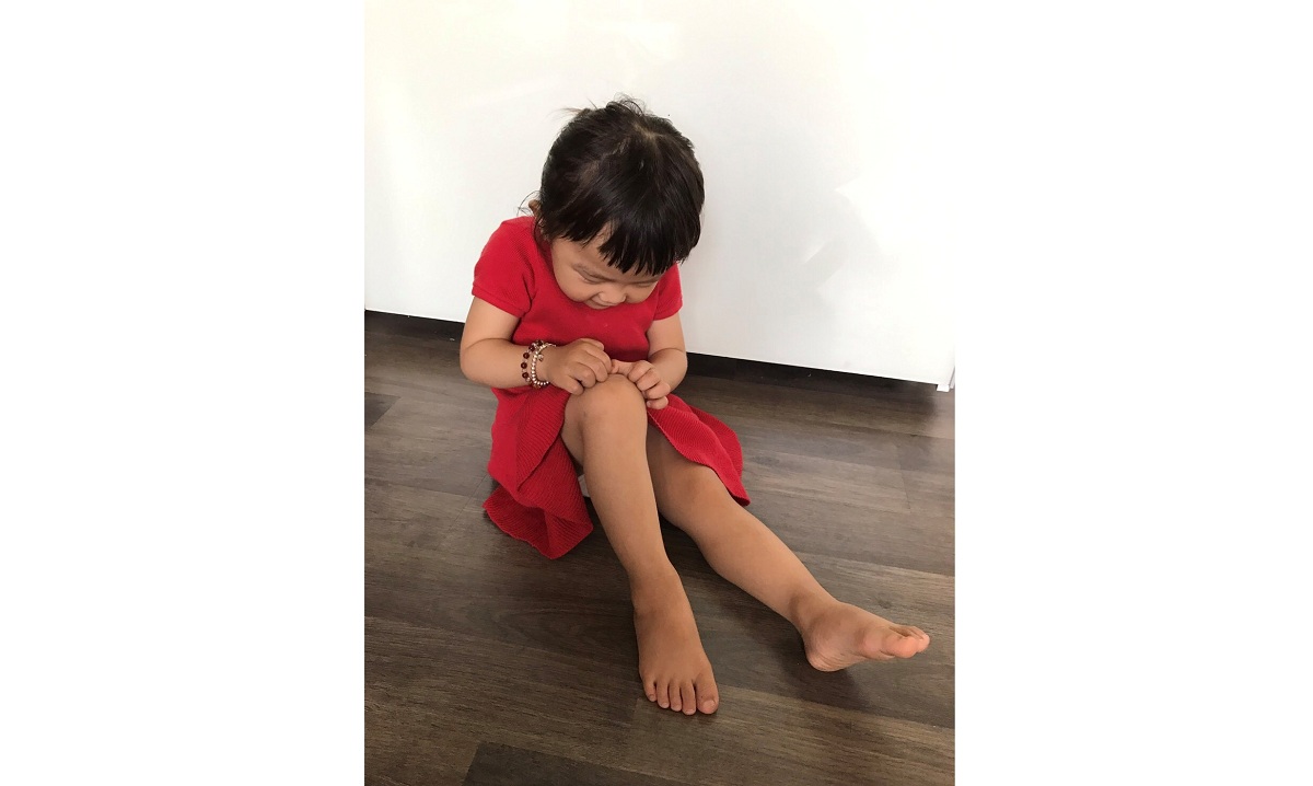 孩子異位性皮膚炎