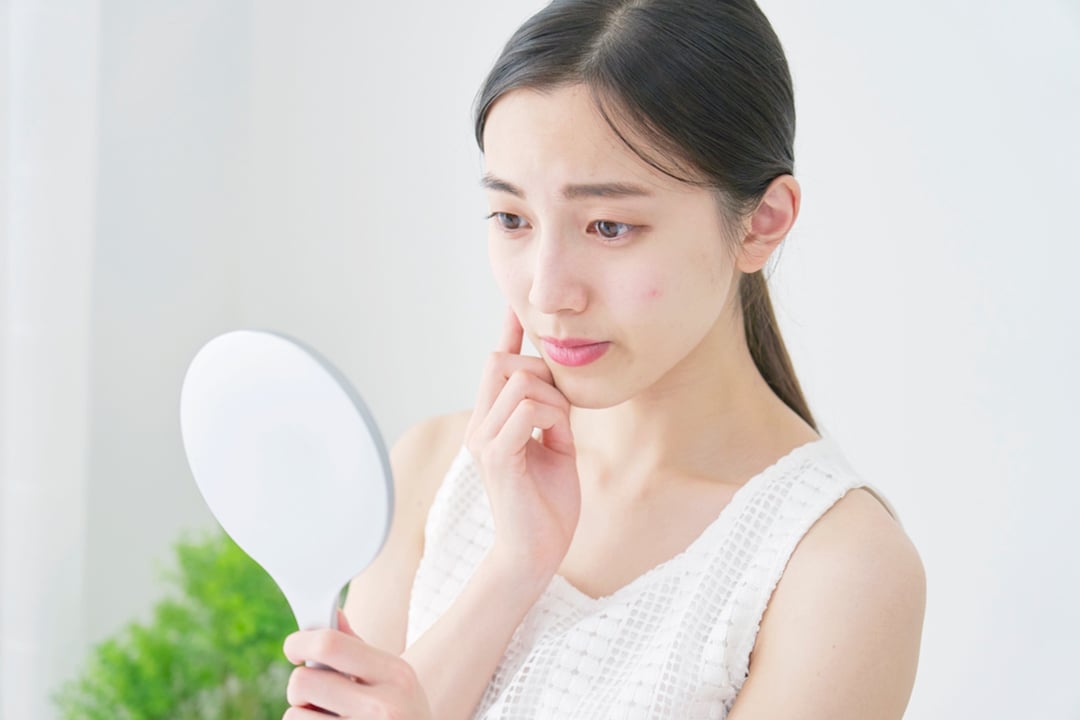 痘痘肌保養指南，掌握4不3保養原則，讓痘痘、粉刺不再困擾你